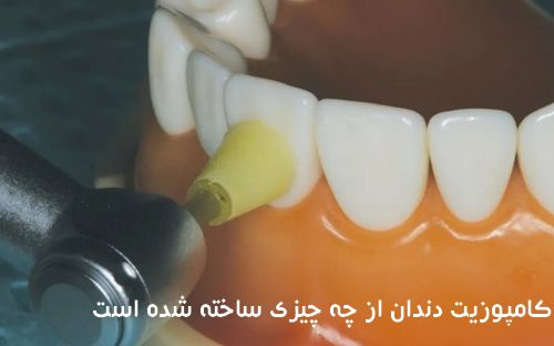  کامپوزیت دندان از چه چیزی ساخته شده است