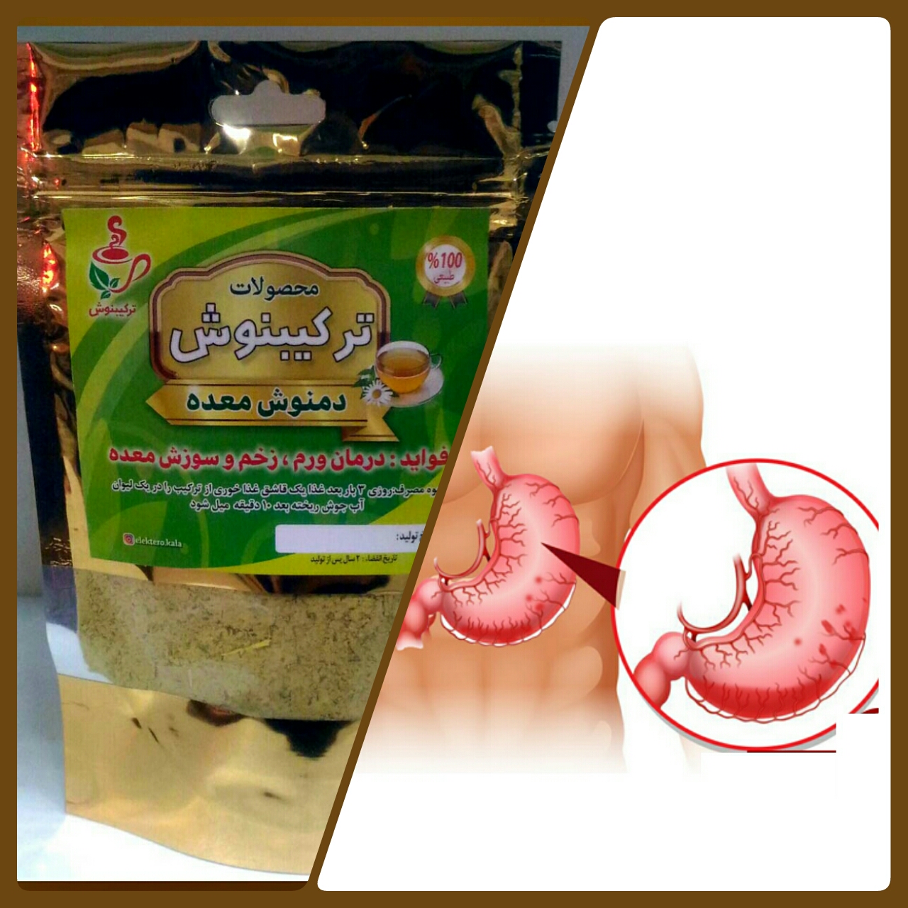 دمنوش معده درد برای معده ی عصبی | گیاهان دارویی الکترو کالا