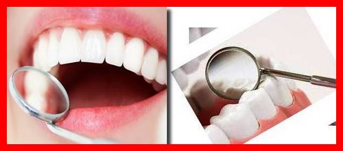 پلاک دندانی چگونه شکل میگیرد + تاثیر اب نمک روی دندان