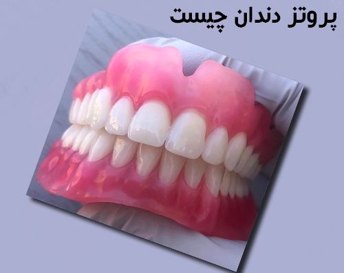 پروتز دندان چیست 