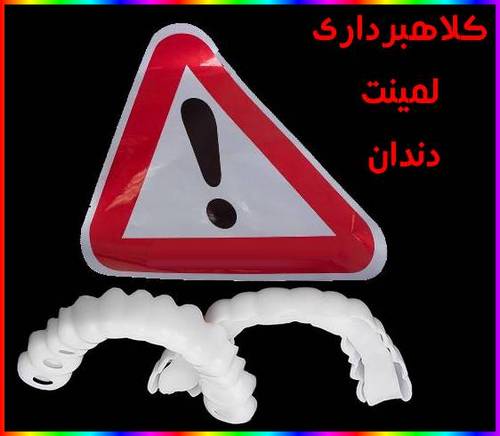 کلاهبرداری لمینت دندان