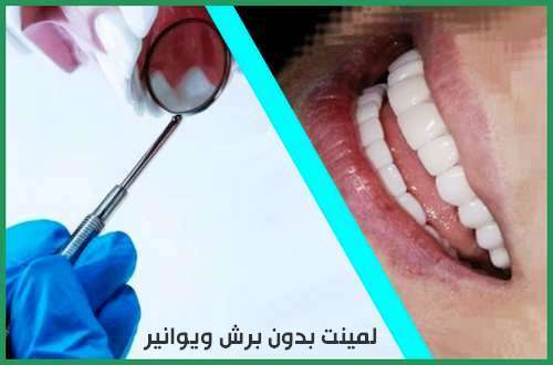لمینت بدون برش ویوانیر