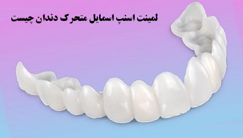 قیمت لمینت موقت دندان دیجی کالا بهتره یا تن جومه + توضيحات 2024