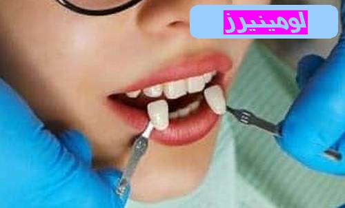 لومینیرز