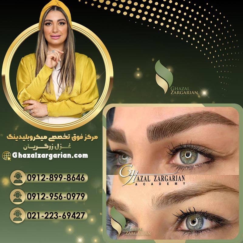 جدیدترین روش فیبروز با قیمت ویزه 